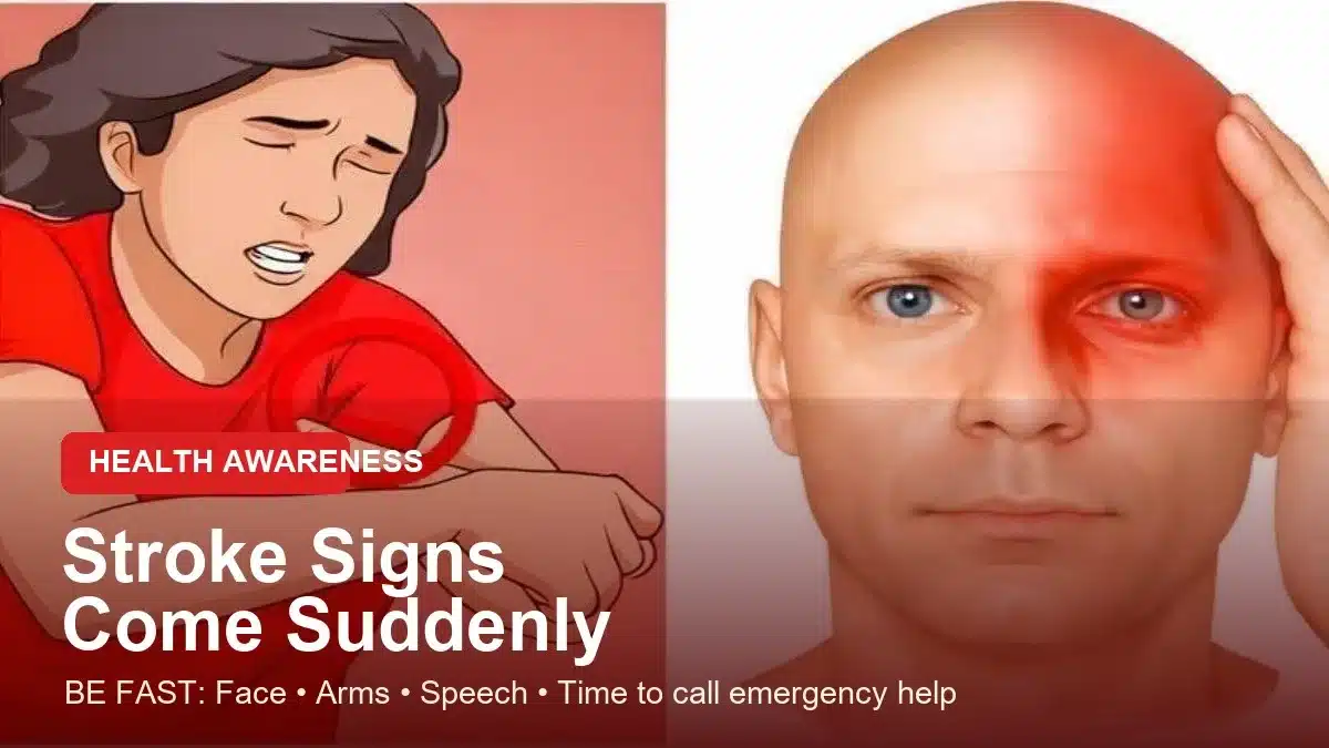 Stroke awareness graphic showing BE FAST warning signs and urgent emergency response message